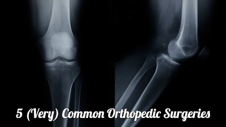 5 (Very) Common Orthopedic Surgeries